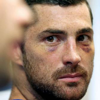 Leinster Issue Injury Update