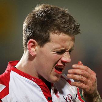 Ulster Hopeful That Gilroy Will Be Available
