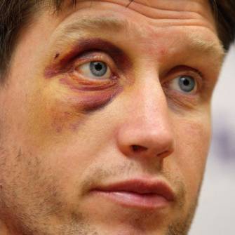 Brive Will Be Tough And Awkward – O’Gara